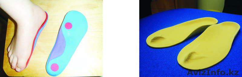 Ортопедическая стелька - Изображение #1, Объявление #435884