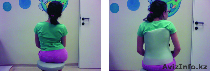 Жесткий корсет по типу Шено - Изображение #1, Объявление #649295