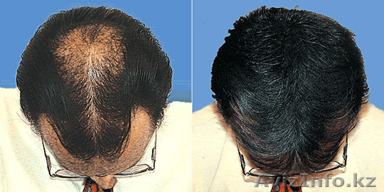 Шампунь больше не понадобится! - Изображение #1, Объявление #1245181