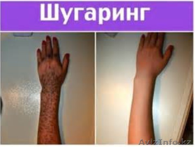 Шугаринг!!!Акция - Изображение #1, Объявление #1318793