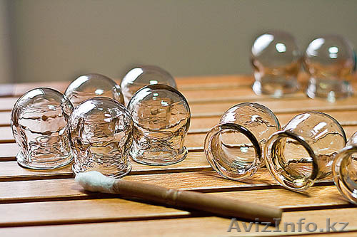 хиджамма в астане профессионально, медик - Изображение #1, Объявление #1428047