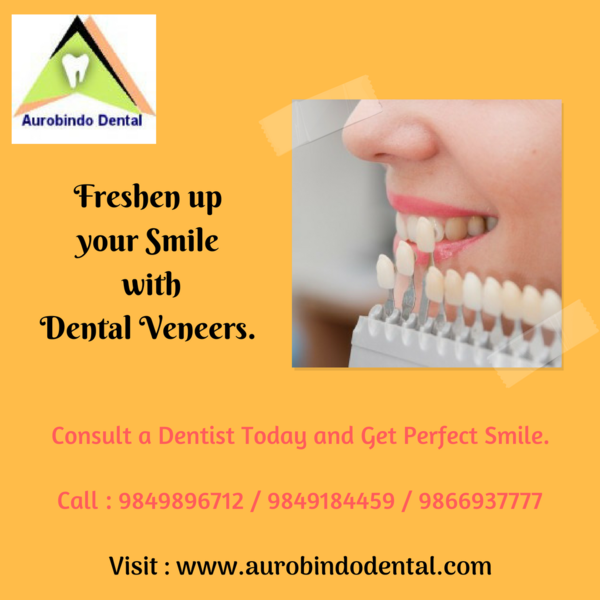 Cosmetic dental clinic and dentist in Hyderabad - Изображение #1, Объявление #1664323