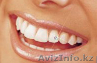 Стоматологический кабинет "VIP-AL-DENT" - Изображение #3, Объявление #697553
