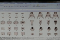 МЕЗОТЕРАПИЯ , ДАРСОНВАЛЬ, ЛЕЧЕНИЕ АКНЕ И ПРОБЛЕМ ПОСТАКНЕ. - Изображение #2, Объявление #751375