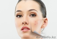 АРАБСКОЕ МЫЛО ОТ ПРЫЩЕЙ VOLCANIC ASH - Изображение #1, Объявление #1322833