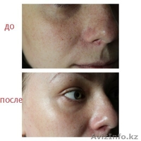 ZEITGARD (Цайтгард) - немецкий прибор для очищения лица - Изображение #7, Объявление #1456557