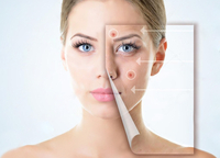 Лазерное лечение акне Лазер «FOTONA» - Изображение #1, Объявление #1678643