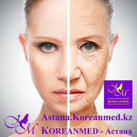 Антивозрастной уход - Омоложение лица - Изображение #2, Объявление #1678595