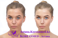 CC Cover Treatment - Изображение #3, Объявление #1678640