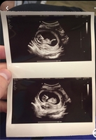 Клинике в Грузии нужны суррогатные матери! - Изображение #1, Объявление #1745069