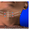 Нитевая подтяжка лица Силуэт Лифт Софт - Изображение #2, Объявление #1036719