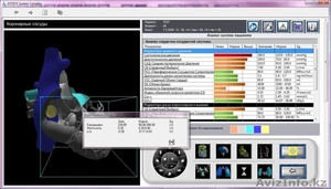 Аппарат функциональной диагностики ESTeck Complex - Изображение #7, Объявление #628641