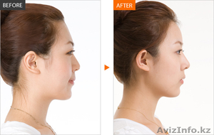 Пластические операции в Южной Корее. Увеличение груди,  липосакция,  итд