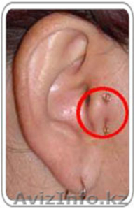 Минус лишние килло!!