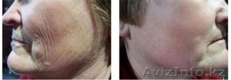 Косметика Glimpse просто чудо - Изображение #3, Объявление #118299