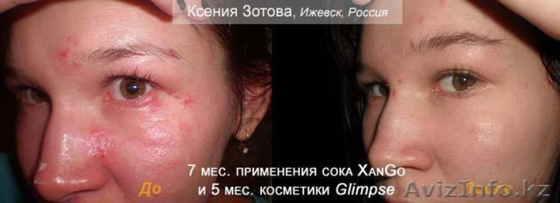 Косметика Glimpse просто чудо - Изображение #1, Объявление #118299