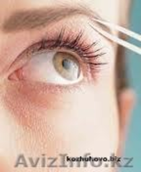 КОСМЕТОЛОГ.Омоложение,подтяжка,отбеливание,RF-лифтинг,   - Изображение #2, Объявление #458356