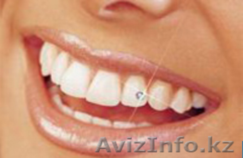 Стоматологический кабинет "VIP-AL-DENT" - Изображение #3, Объявление #697553