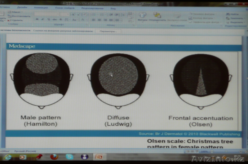 МЕЗОТЕРАПИЯ , ДАРСОНВАЛЬ, ЛЕЧЕНИЕ АКНЕ И ПРОБЛЕМ ПОСТАКНЕ. - Изображение #1, Объявление #751375