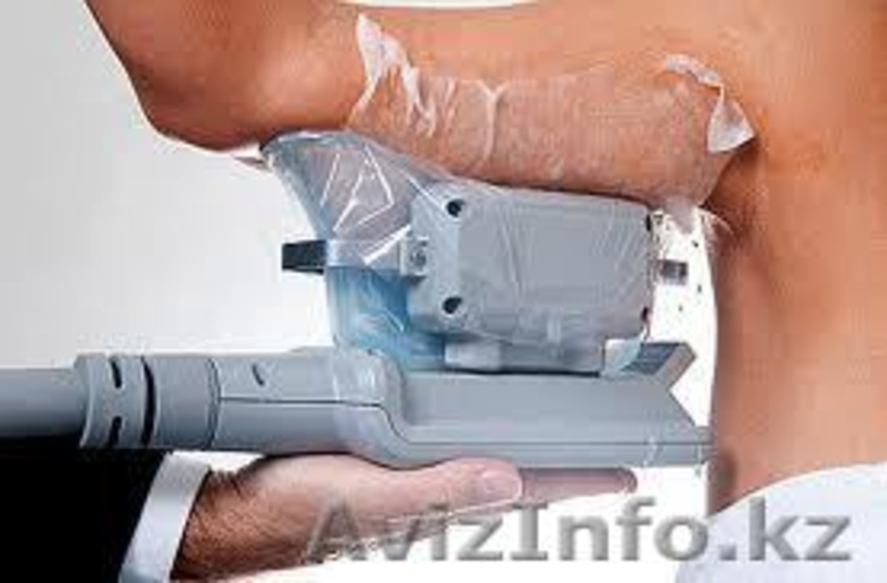  Криолиполиз -   революционная методика сжигания жира! Криолиполиз: все л - Изображение #5, Объявление #865089