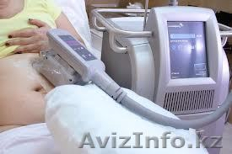  Криолиполиз -   революционная методика сжигания жира! Криолиполиз: все л - Изображение #2, Объявление #865089