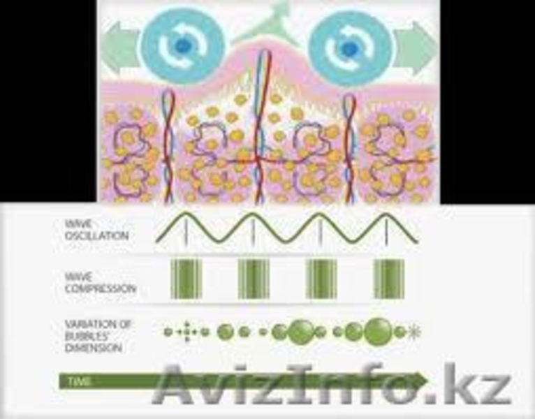 инновация!!! Аппаратный вакуумно-роликовый массаж, лимфодренажный массаж (LPG) - Изображение #2, Объявление #865099