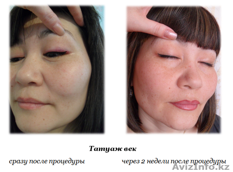 Татуаж (перманентный макияж) бровей, век, губ - Изображение #5, Объявление #1023062