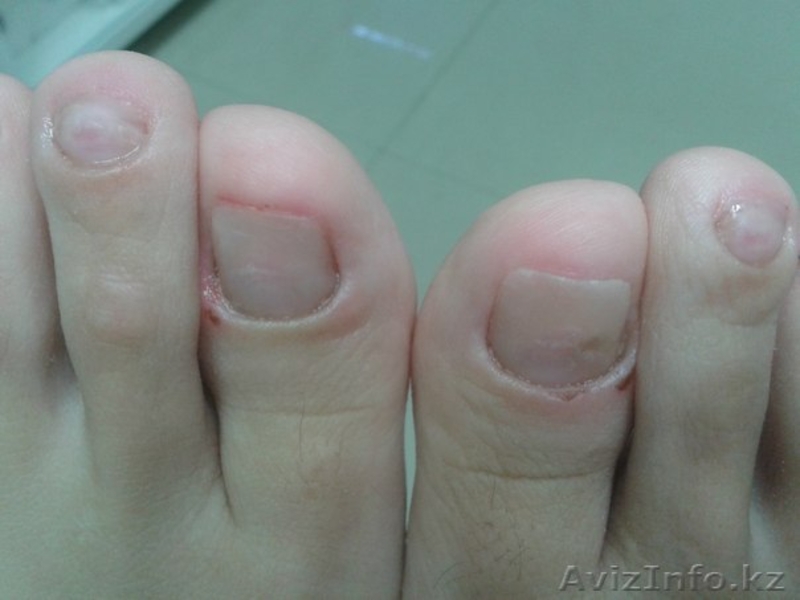 Центр подологии  - Изображение #3, Объявление #1232897