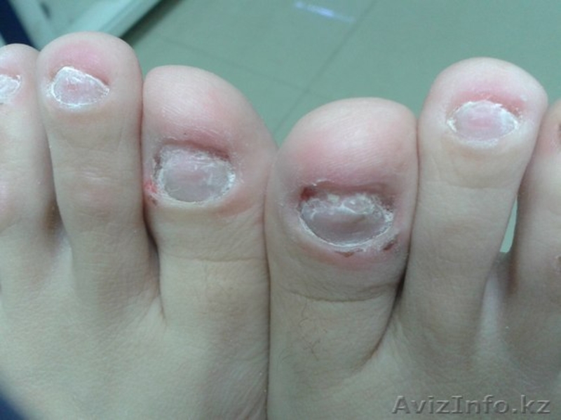 Центр подологии  - Изображение #2, Объявление #1232897