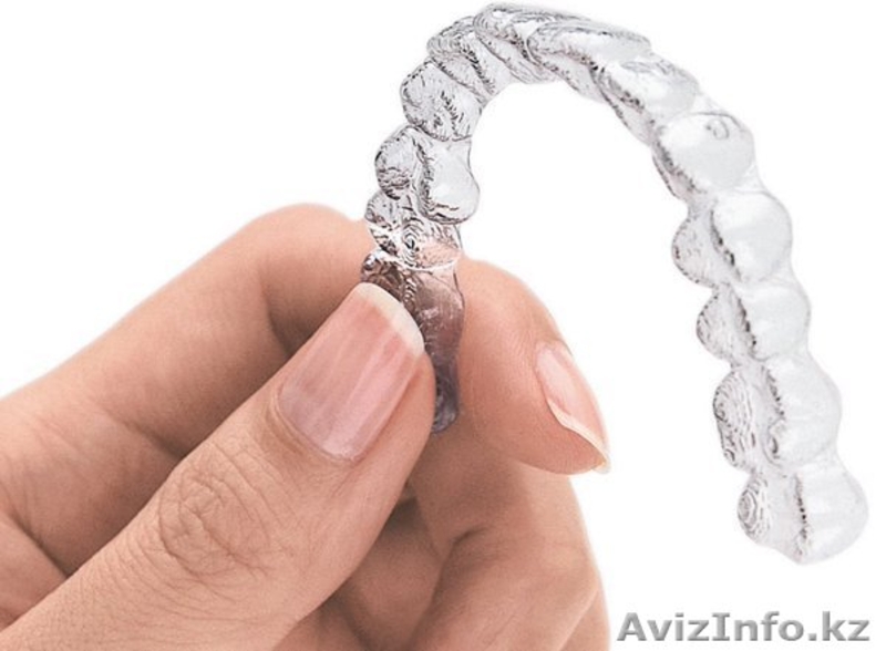 Скорость исправления прикуса,эстетика и гигиена - Изображение #1, Объявление #1497107