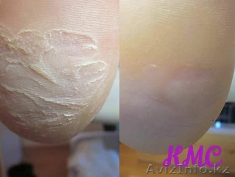 Маникюр, Педикюр, Шугаринг! - Изображение #3, Объявление #1535759