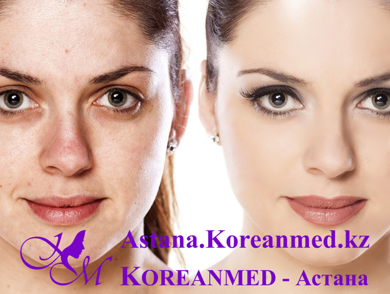 Стимулирующая процедура с золотой маской - Изображение #2, Объявление #1678618