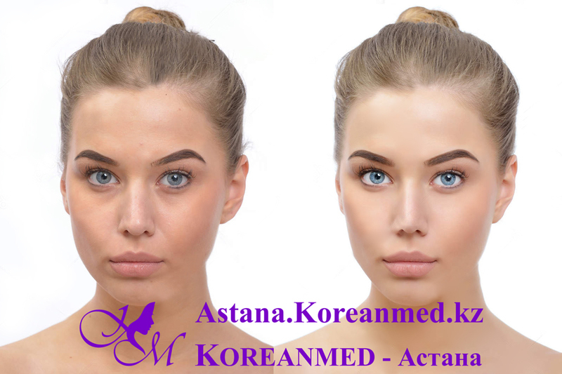 CC Cover Treatment - Изображение #3, Объявление #1678640