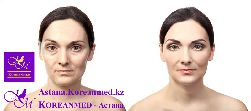 Diamond Face - Изображение #4, Объявление #1678590