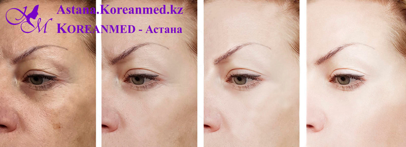 Гипсовая маска – Маска для лица - Изображение #4, Объявление #1678617