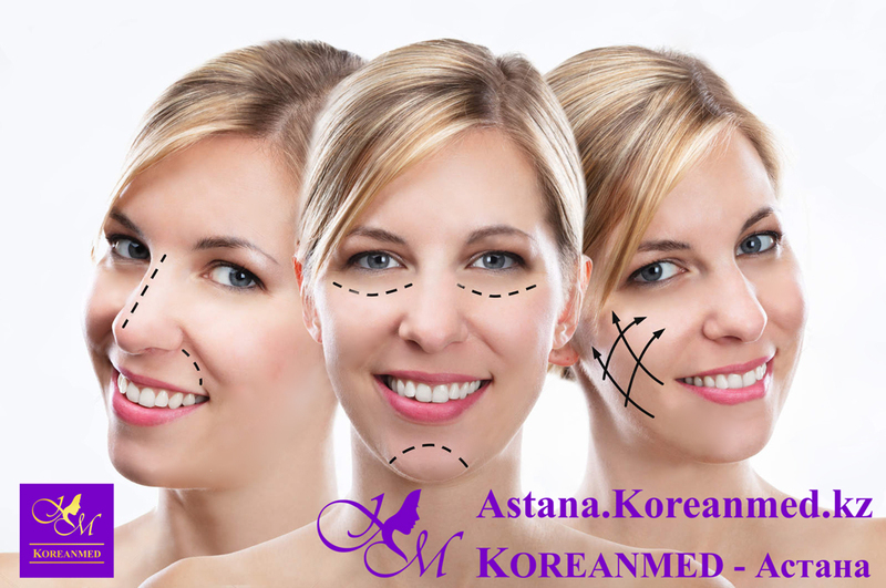 Лифтинг «Нефертити» - Изображение #3, Объявление #1678587