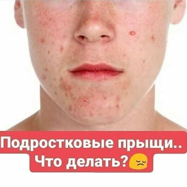 Здоровье превыше всего! - Изображение #2, Объявление #1709876