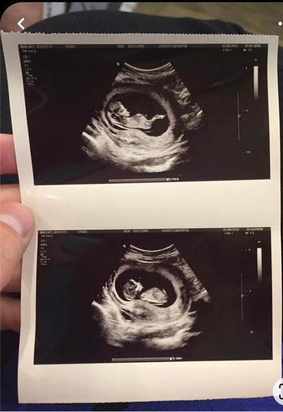 Клинике в Грузии нужны суррогатные матери! - Изображение #1, Объявление #1745069